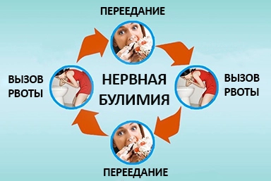 Лечение булимии в Сухом Логе
